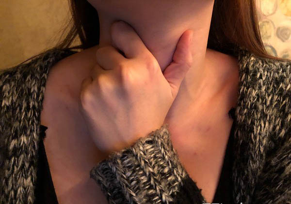 Những dấu hiệu ban đầu của ung thư thực quản rất dễ bị nhầm lẫn, xem nhẹ (Ảnh minh họa)